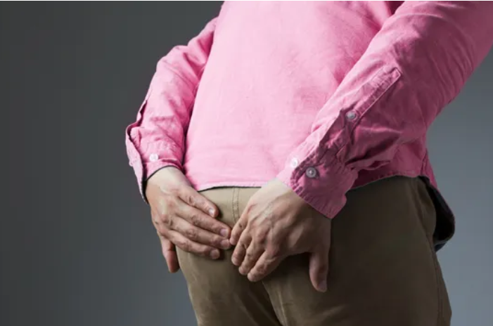 Abses Perianal