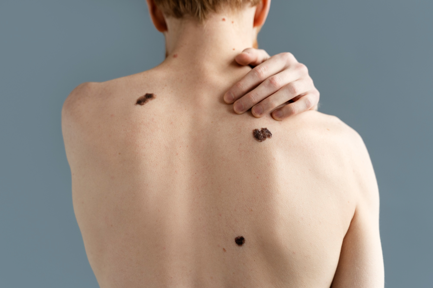 Warts (Kutil)