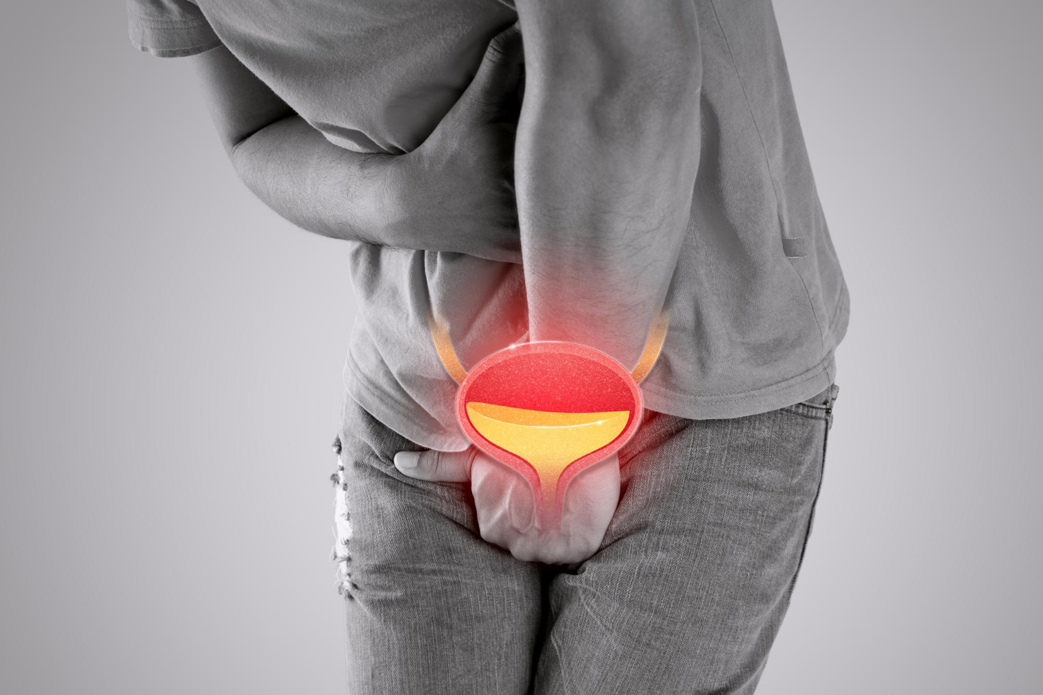 Cystitis (Infeksi Kandung Kemih)