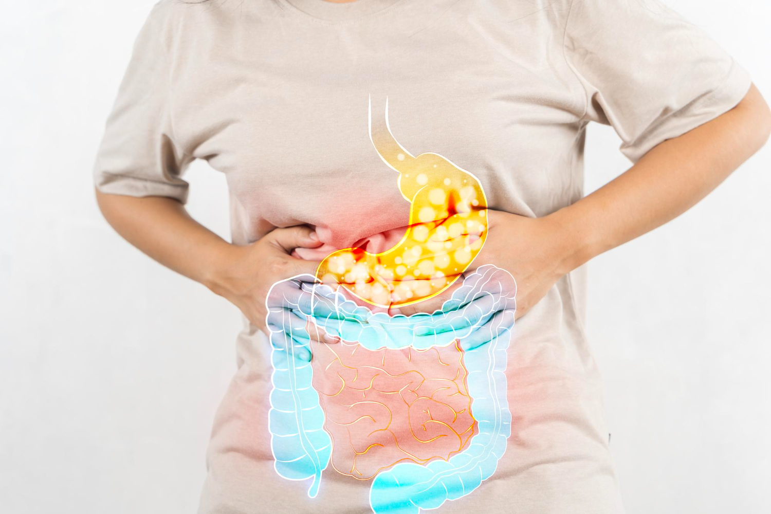 Irritable Bowel Syndrome (IBS)